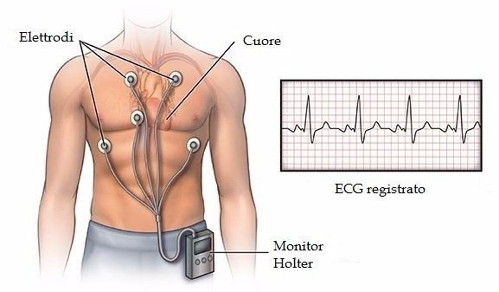 ECG - Elettrocardiogramma